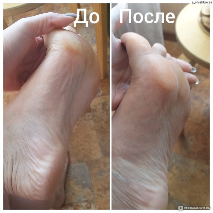 Вязание пятки