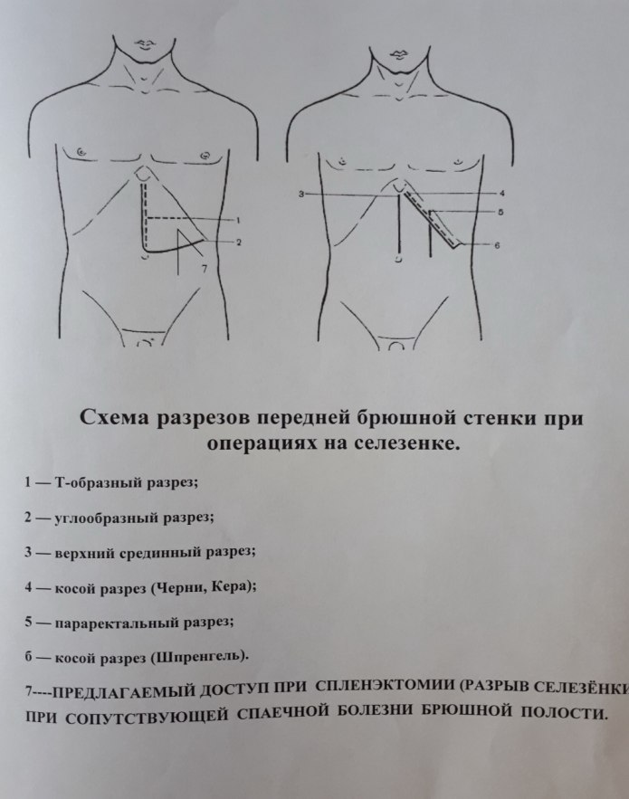 Оперативные доступы к селезенке