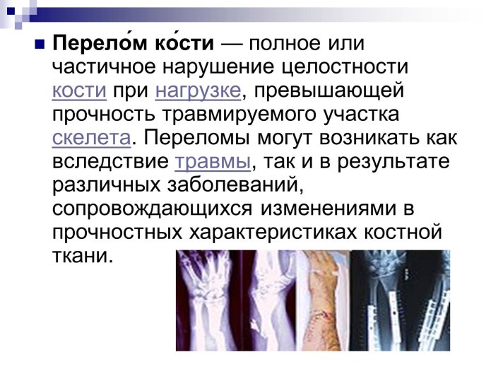 Перелом кости презентация