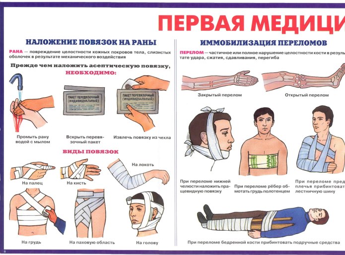 Транспортная иммобилизация при ожогах