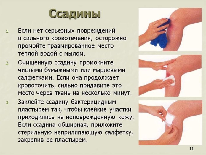 Оказание первой помощи при порезах и ссадинах