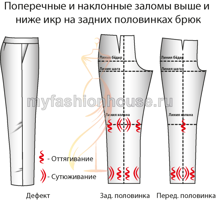 Дефекты посадки брюк